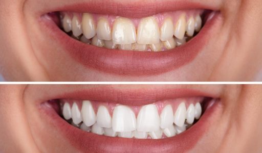 Cosmetic Dentistry