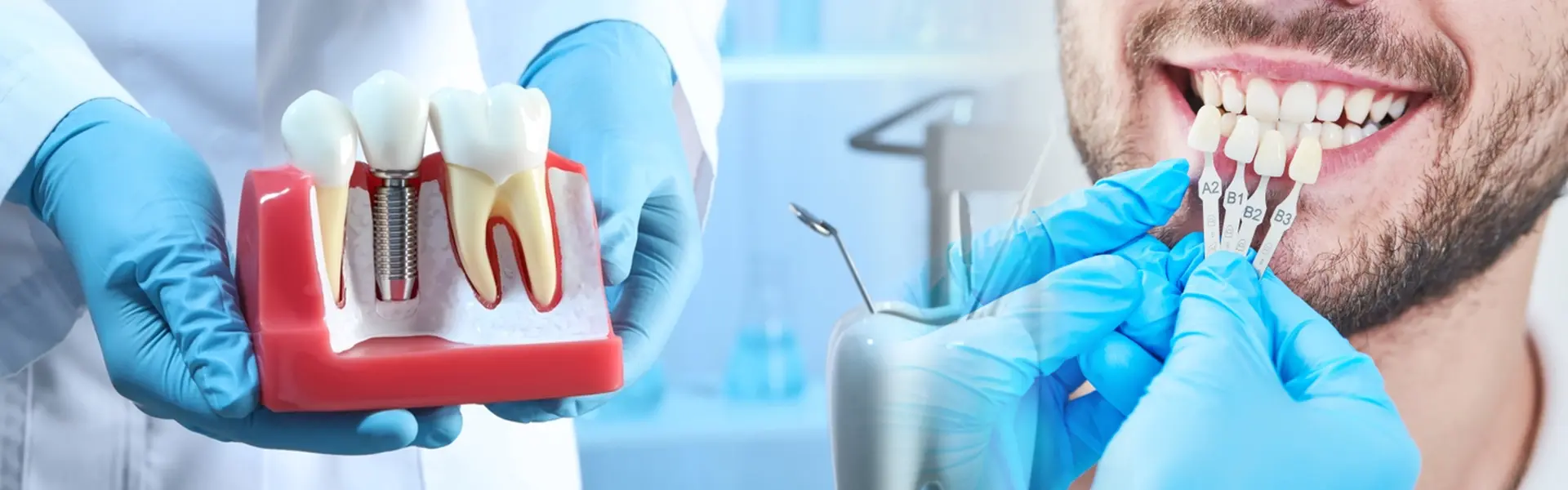 Implant-Case Implant-Case