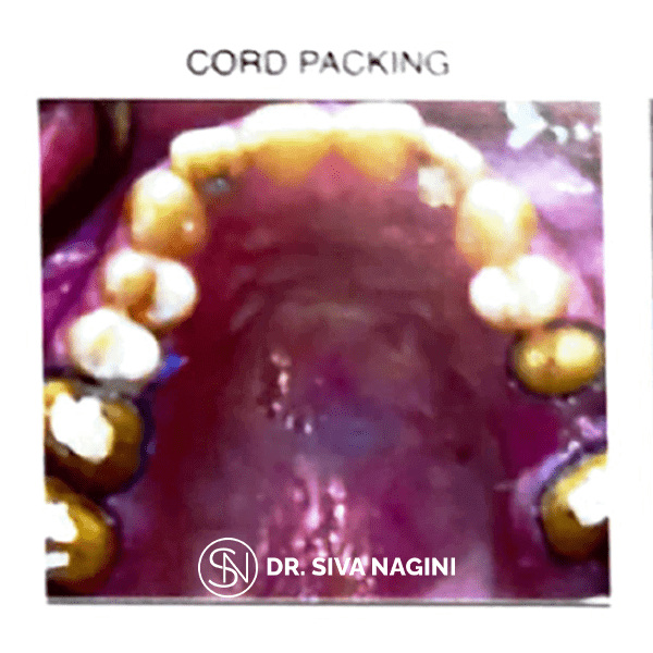 Name-Selvi-Age-23-(10)