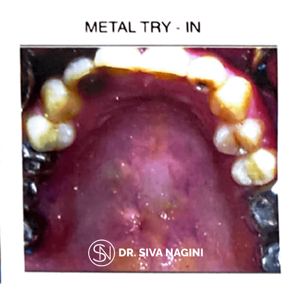 Name-Selvi-Age-23-(12)