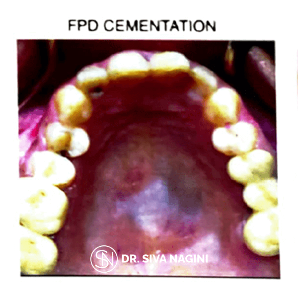 Name-Selvi-Age-23-(13)