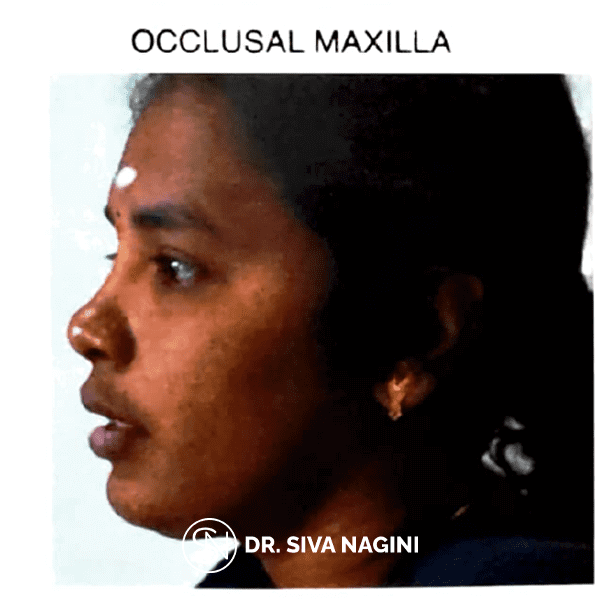 Name-Selvi-Age-23-(2)