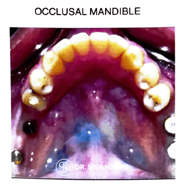 Name-Selvi-Age-23-(3)