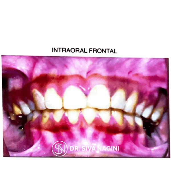 Name-Selvi-Age-23-(4)