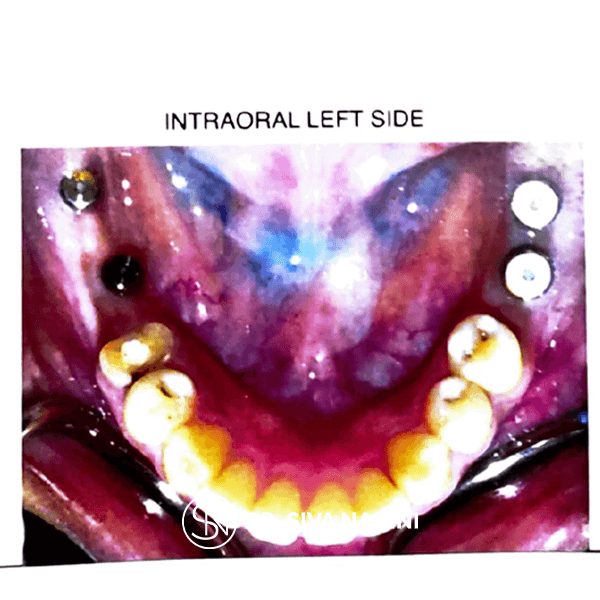 Name-Selvi-Age-23-(6)