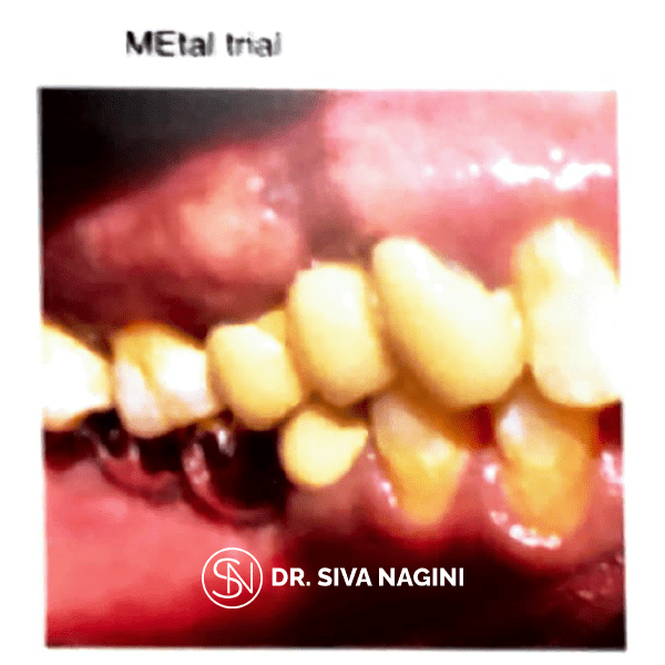 Name-Somasundaram-Age-60-(10)