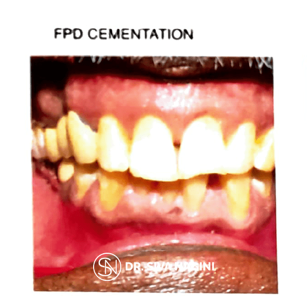 Name-Somasundaram-Age-60-(12)