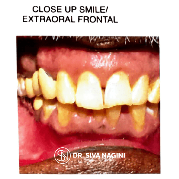 Name-Somasundaram-Age-60-(13)