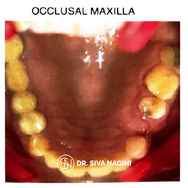 Name-Somasundaram-Age-60-(2)