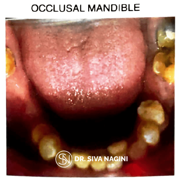 Name-Somasundaram-Age-60-(3)