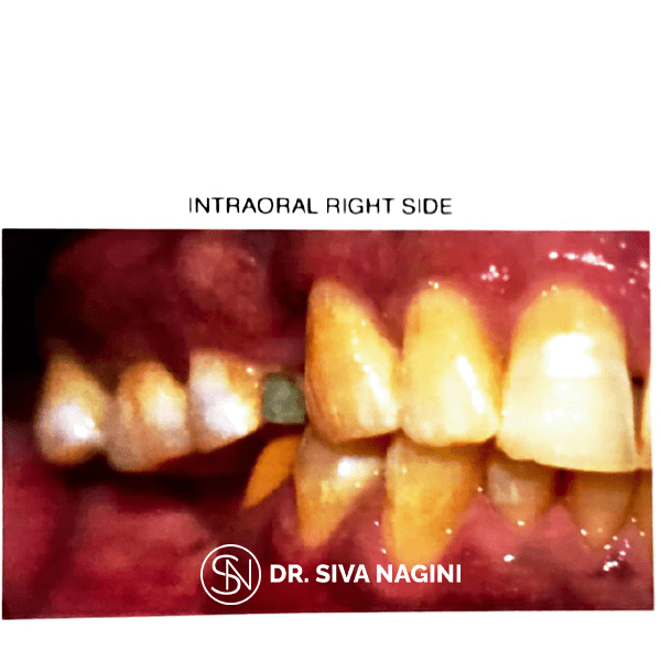 Name-Somasundaram-Age-60-(5)