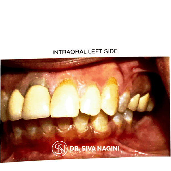 Name-Somasundaram-Age-60-(6)