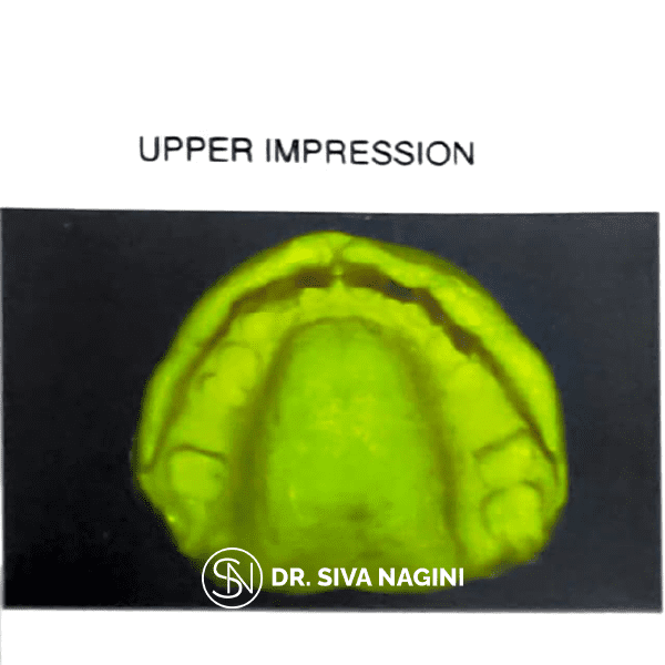 Name-Somasundaram-Age-60-(7)