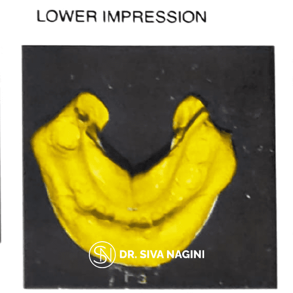 Name-Somasundaram-Age-60-(8)