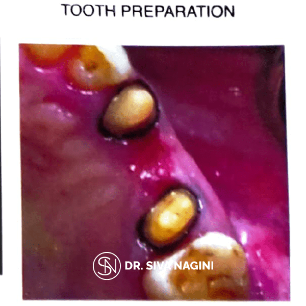 Name-Somasundaram-Age-60-(9)