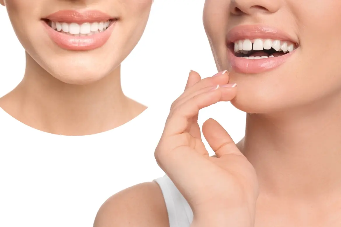 The-problem-which-Kavitha-was-facing-–-Diastema-Thumbnail