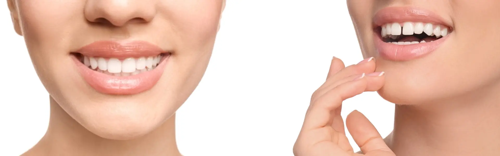 The-problem-which-Kavitha-was-facing-–-Diastema The-problem-which-Kavitha-was-facing-–-Diastema