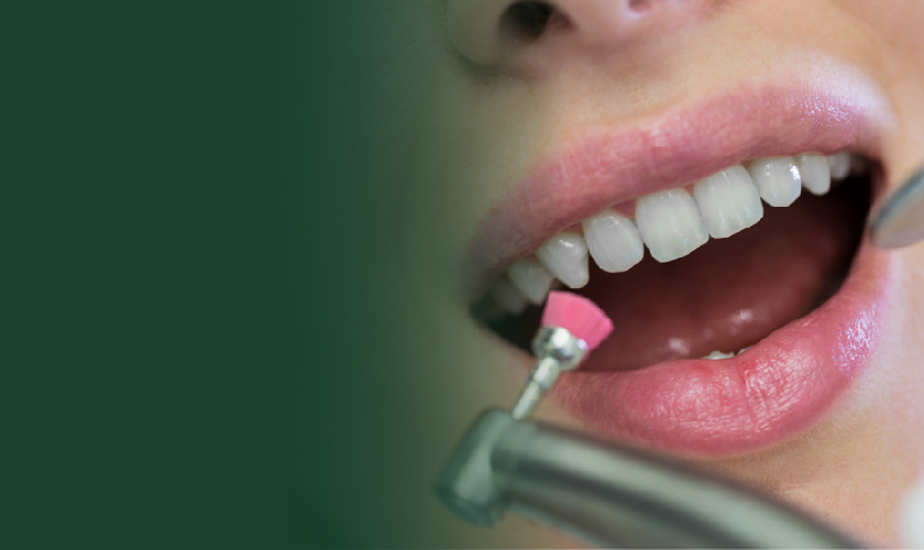 gum depigmentation-05